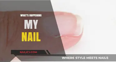 Unraveling Nail Mysteries: What's Happening to My Nail Health?