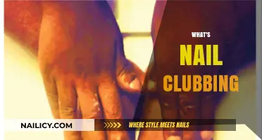 Understanding Nail Clubbing: Causes, Symptoms, and When to Seek Help