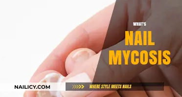 Understanding Nail Mycosis: Causes, Symptoms, and Effective Treatment Options