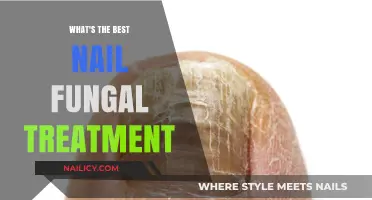 Effective Nail Fungal Treatment Options: A Comprehensive Guide to Clear Nails