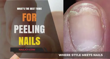 Nail Care Secrets: Top Remedies for Peeling Nails Revealed