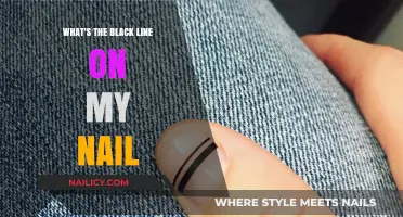 Understanding the Black Line on Your Nail: Causes and Concerns