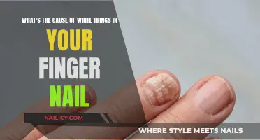 Unraveling the Mystery: Why Your Nails Turn White