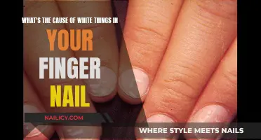 White Spots on Nails: What's the Cause?