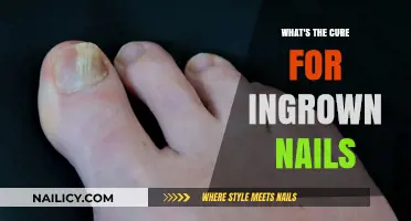 Effective Remedies and Prevention Tips for Painful Ingrown Toenails