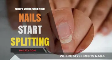 Why Your Nails Are Splitting: Causes and Solutions for Brittle Nails