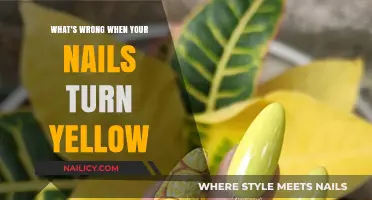 Yellow Nails: Causes, Concerns, and Solutions for Healthy Hands