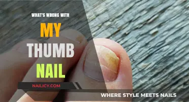 Why Is My Thumb Nail Discolored, Brittle, or Abnormal?
