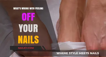 The Hidden Dangers of Peeling Off Your Nails: What to Know