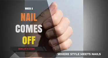 Nail Loss: Causes, Care, and Recovery Tips for Healthy Nails