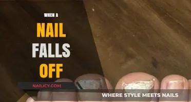 Nail Loss Explained: Causes, Care, and Recovery Tips for Toenails