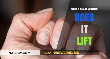 Does Your Nail Lift When Growing?
