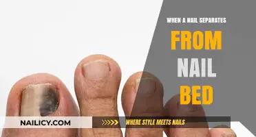 Nail Separation from Nail Bed: Causes, Symptoms, and Treatment Options