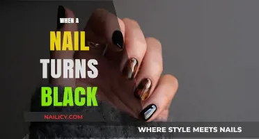 Why Your Nail Turns Black: Causes, Concerns, and Treatment Options