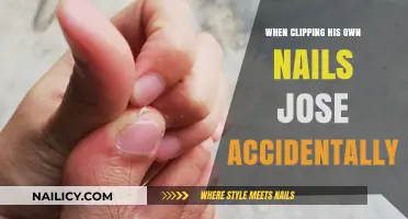 Jose’s Nail Clipping Mishap: A Painful Lesson in Self-Care