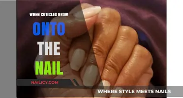 Cuticles: When They Grow onto Your Nails