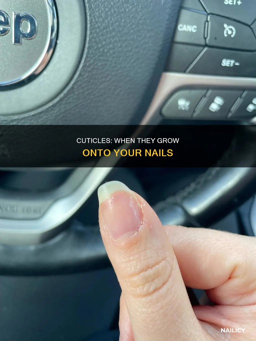 when cuticles grow onto the nail