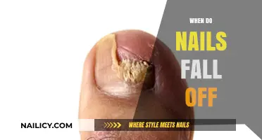 When Do Nails Fall Off? Causes, Symptoms, and Treatment Options