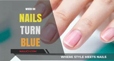 Why Nails Turn Blue: Causes, Concerns, and When to Seek Help