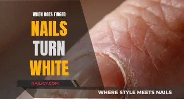 Understanding the Causes of White Nails: A Comprehensive Guide