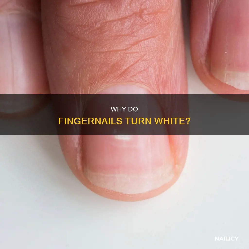 when does finger nails turn white
