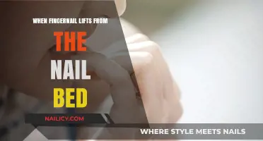 Why Fingernails Lift: Causes, Symptoms, and Effective Treatment Options