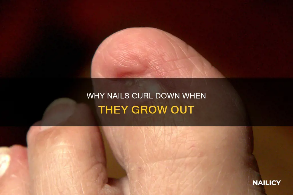when grow out why do my nails curl down