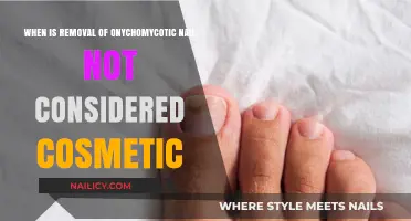 Onychomycotic Nail Removal: When Is It Medically Necessary?