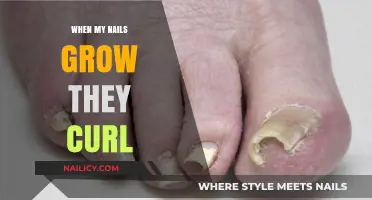 Nails Curling? Here's Why and How to Fix It
