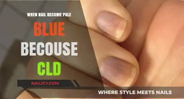 Pale Blue Nails and Cold Exposure: Causes and Concerns