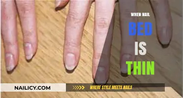 Thin Nail Beds: Causes, Prevention, and Effective Care Tips