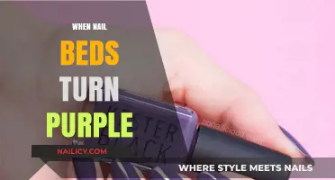 Why Nail Beds Turn Purple: Causes, Concerns, and When to Seek Help