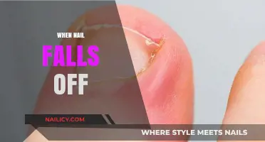 Nail Loss Explained: Causes, Care, and Recovery Tips for Healthy Nails