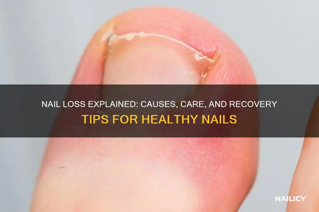 when nail falls off