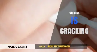 Why Your Nails Crack: Causes, Prevention, and Effective Solutions