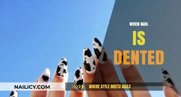 Dented Nails: Causes, Prevention, and Effective Repair Solutions Explained