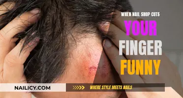 Ouch! A Nail Shop Cut My Finger