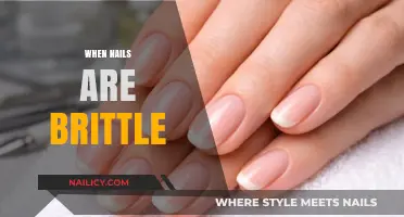 Brittle Nails? Causes, Prevention, and Effective Treatment Solutions Revealed