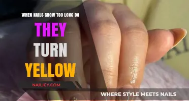 Long Nails Turning Yellow: Why and How to Prevent It