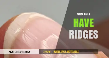 Understanding Ridges on Nails: Causes, Concerns, and Care Tips