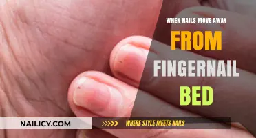 Why Nails Lift: Causes and Solutions for Separating Nail Beds