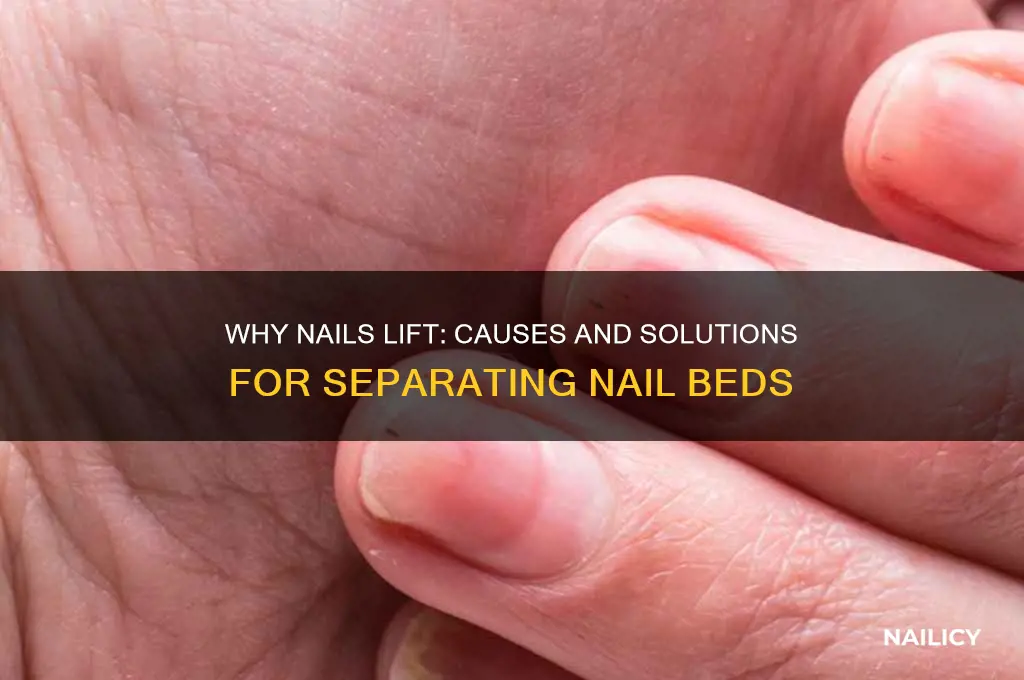 when nails move away from fingernail bed