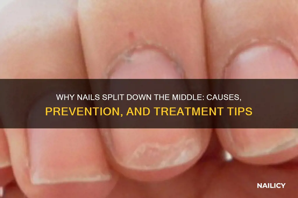 when nails split down middle