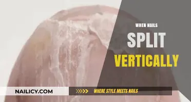 Why Nails Split Vertically: Causes, Prevention, and Effective Treatment Tips
