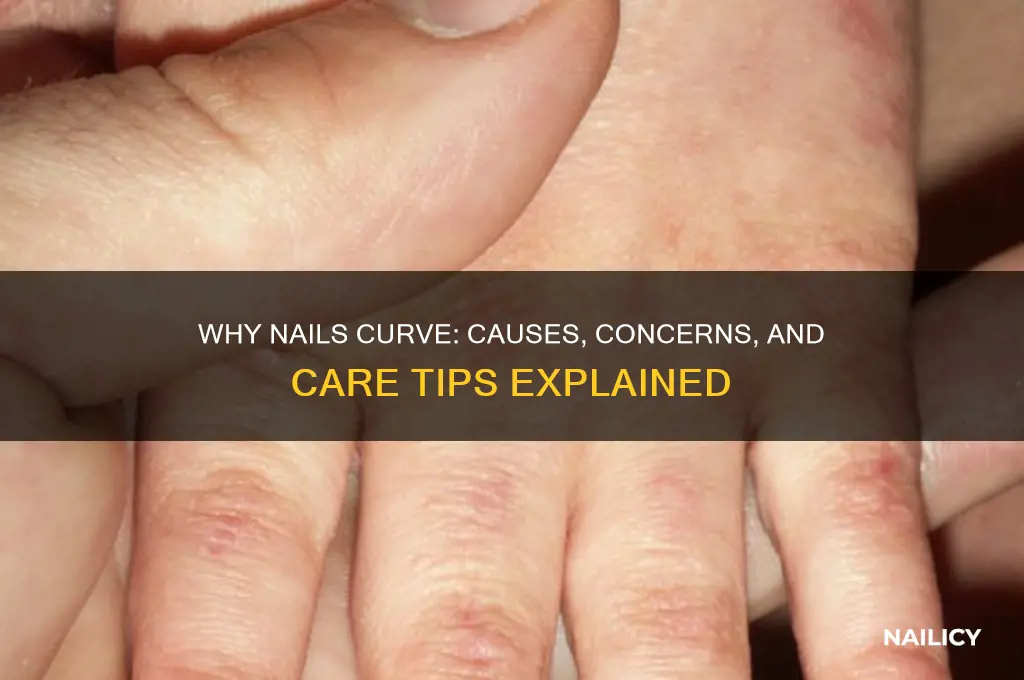 when nails start to curve