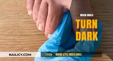 Why Nails Turn Dark: Causes, Concerns, and Treatment Options Explained