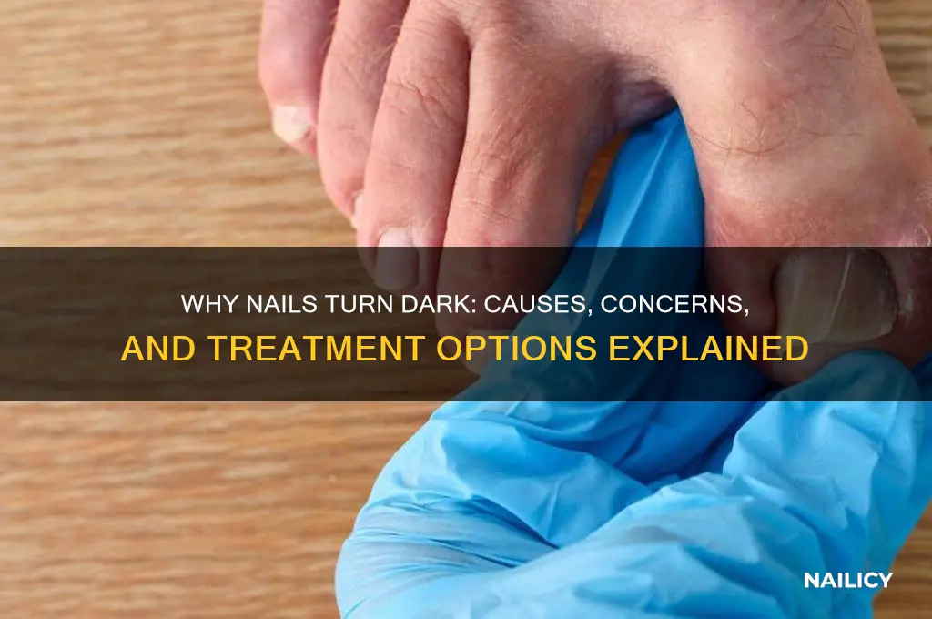 when nails turn dark
