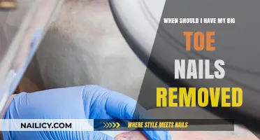 Toe Nail Removal: When Is It Necessary?