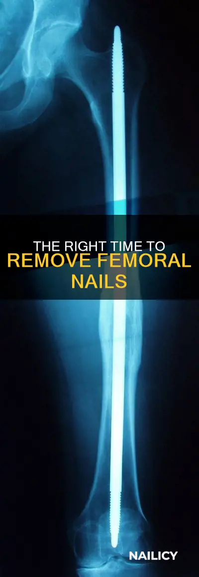 when should we remove the femoral nail