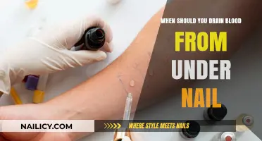 When to Drain Blood from Under a Nail: A Guide